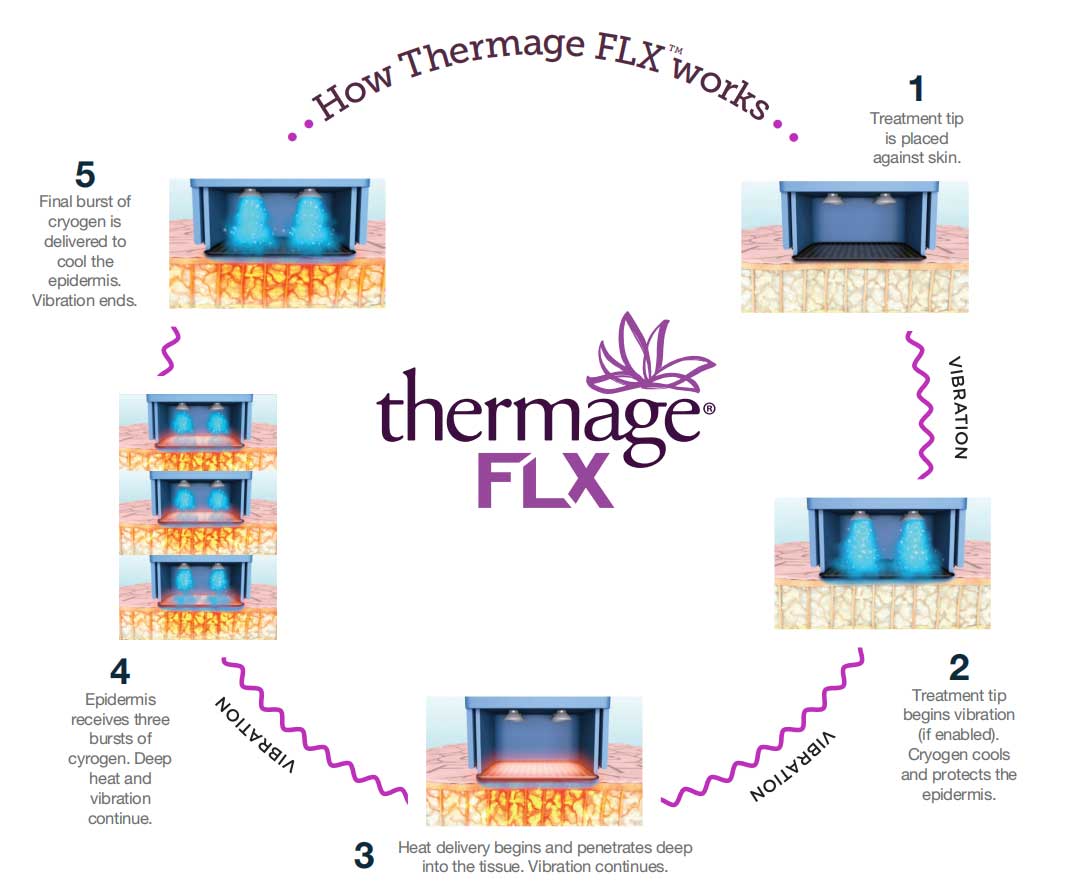 Thermage-FLX-Blog-658