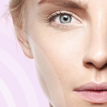RF Microneedling with AstraRF