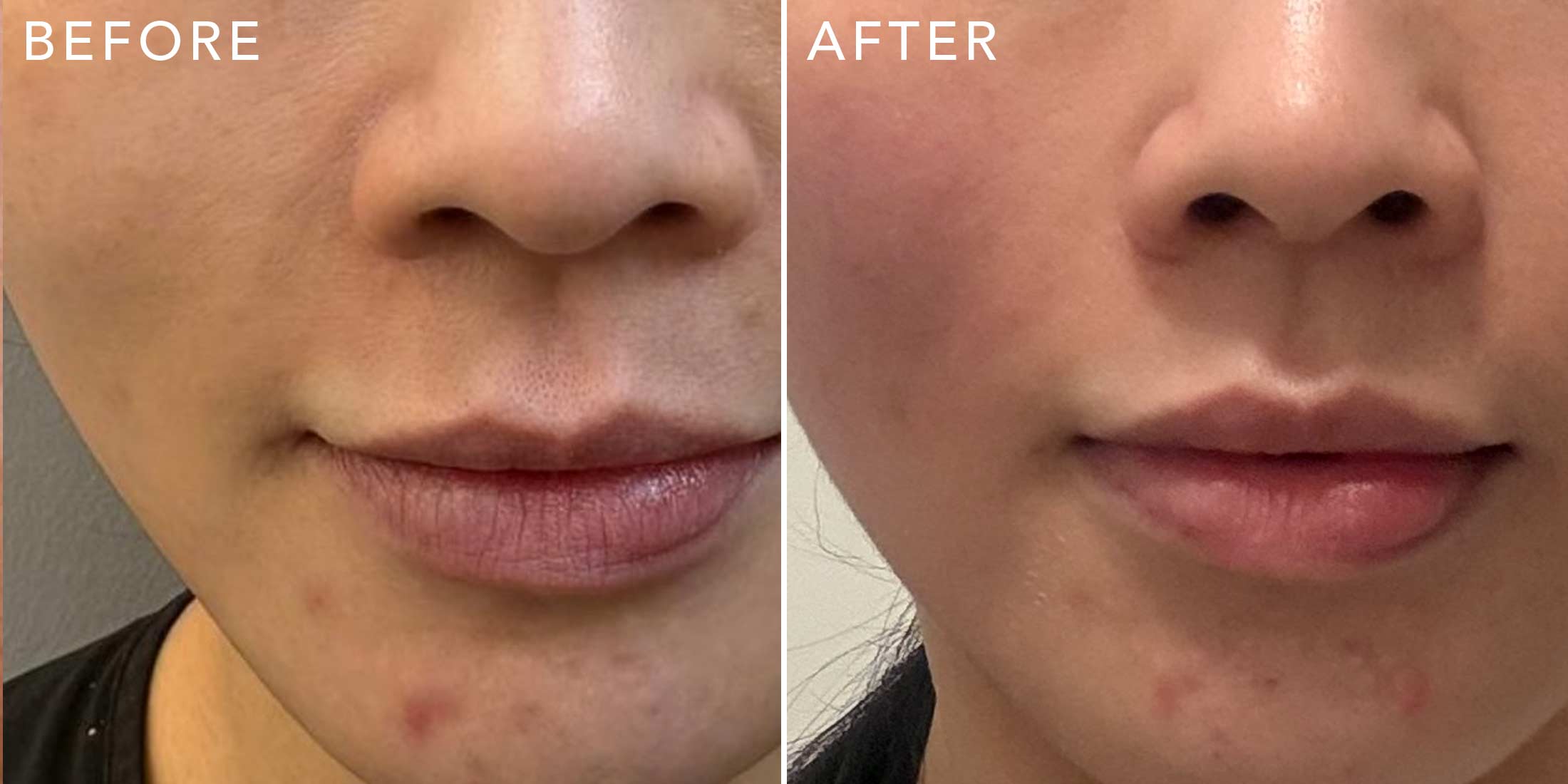 Before-After-Close-B